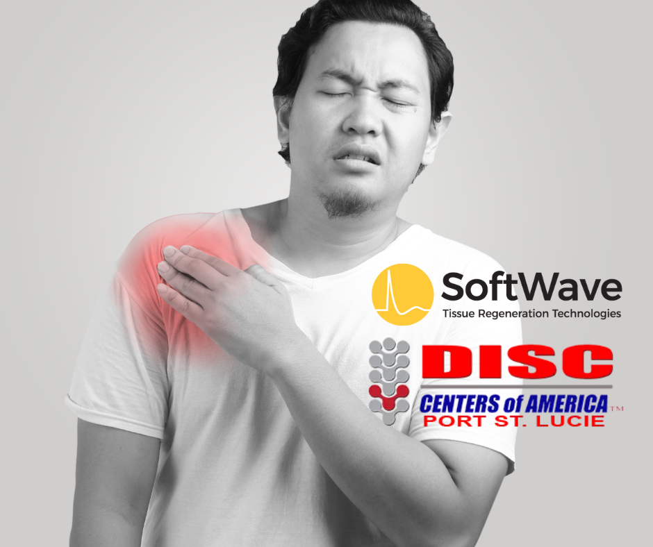 Relieving Shoulder Impingement Syndrome with SoftWave Tissue Regeneration Technology